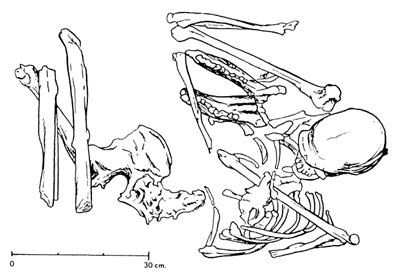 OTTE et NOIRET fig 2