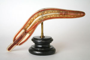 echinorhynchus